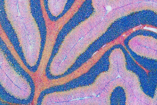 An image of a mouse cerebellum stained pink and blue