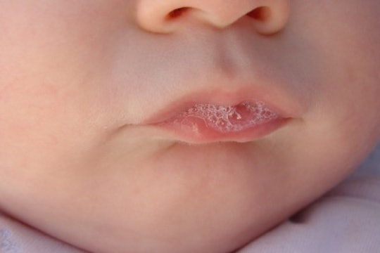 ittle baby with saliva on his lips